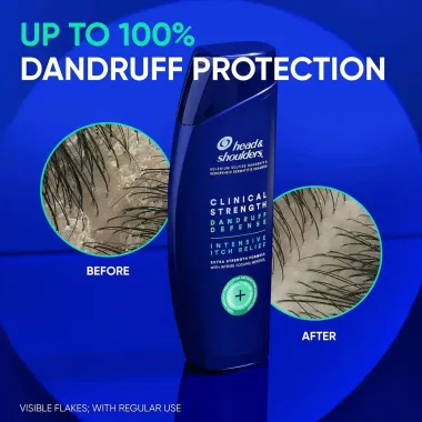 Dầu Gội Trị Gàu Head & Shoulders Clinical Strength 400ml (Mỹ)