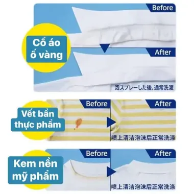 Bình xịt Kao Attack tẩy cổ áo, tay áo 300ml - Nội địa Nhật